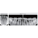 RX EzRay Air Wall Vatech