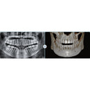 CBTC VATECH SMARTPLUS CEPH