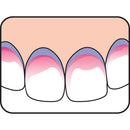 Pastillas detectoras de placa