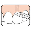 Tepe Bridge Implant Floss para implantes