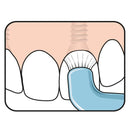 TePe para el cuidado de implantes