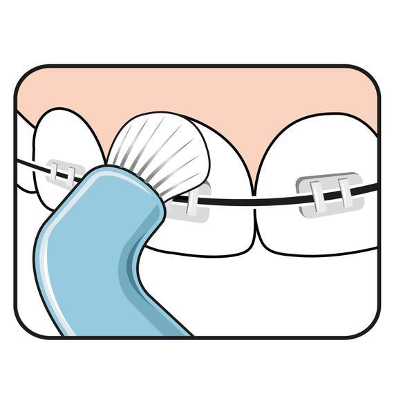 TePe Compact Tuft para ortodoncia