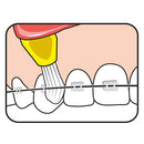 Cepillo TePe Interspace para ortodoncias